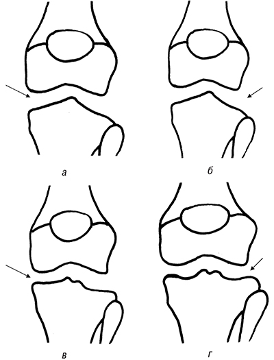 fig-1