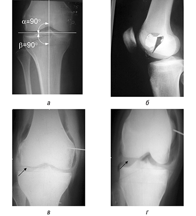 fig-2