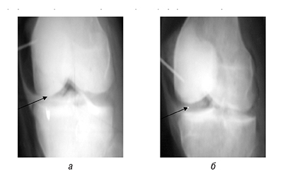 fig-3